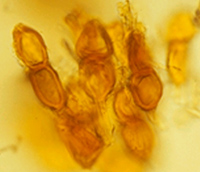 Microscope image