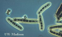 Drechslera under a microscope