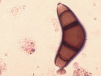Curvularia under a microscope