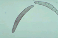 Bipolaris under a microscope
