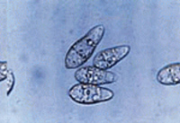 Pyricularia grises under a microscope