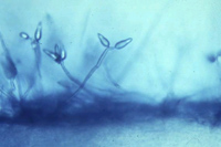conidiophores showing the conidia on stalks under a microscope