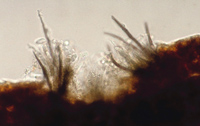 Microscopic image of the long black setae indicative of Colletotrichum