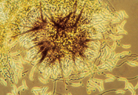Overhead view of the long black setae under a microscope