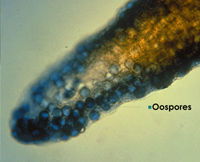 Oospores of Pythium under a microscope, attached to a blade of grass