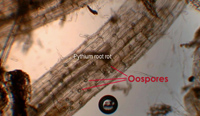 Magnified microscopic view of the tiny oospores indicating Pythium root rot