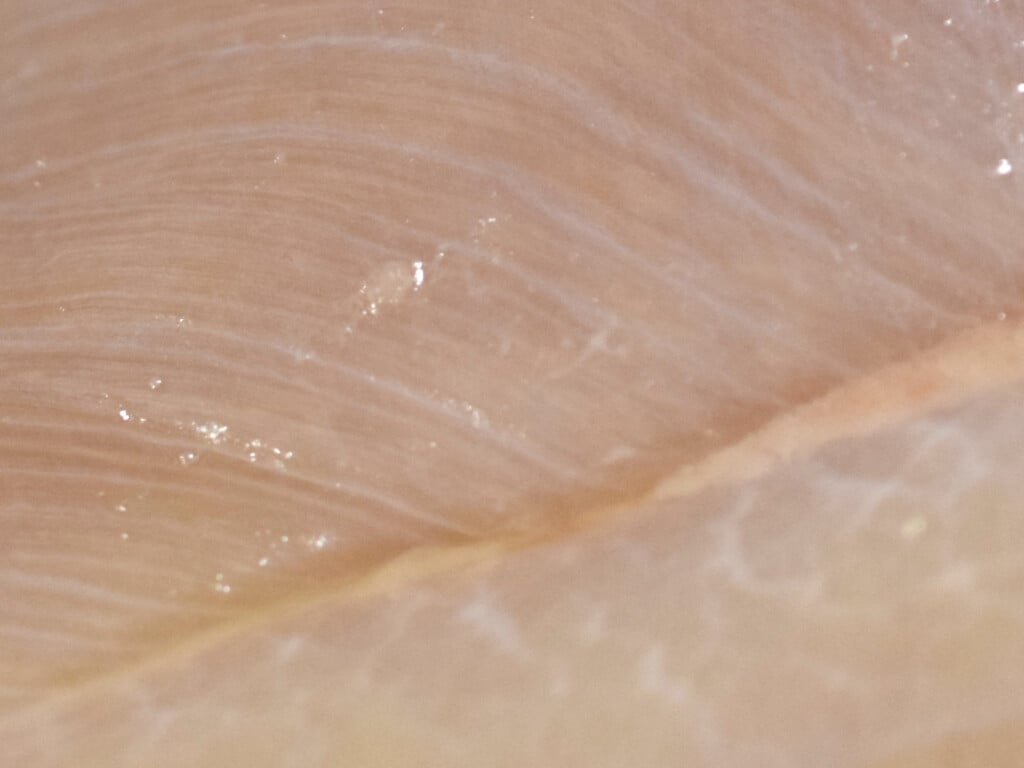 White Striping in Broiler Breast Meat