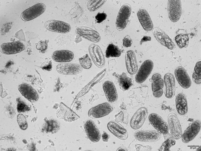 a microscope image of root-knot nematode eggs shows their oval shape