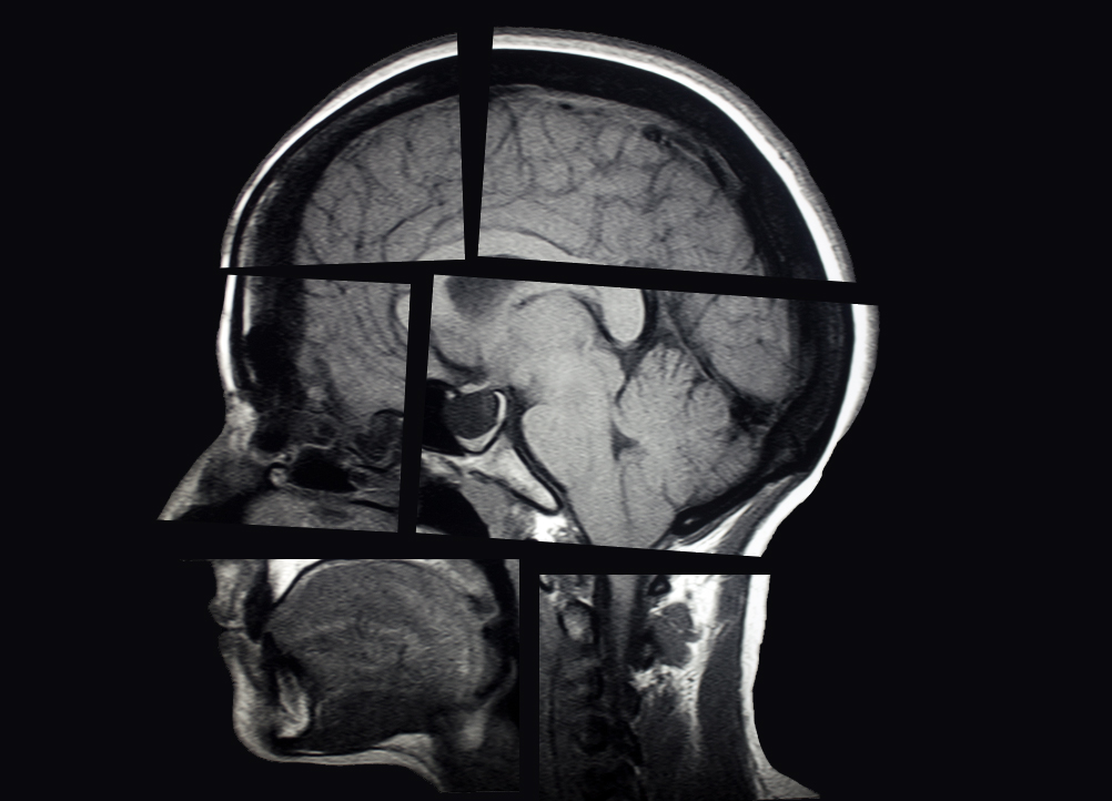 A scientific scan of the brain.